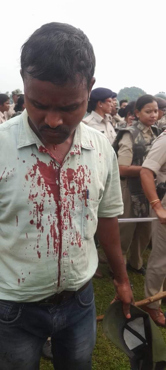 vilas1818's tweet image. #hasdev #हसदेवजंगल #hasdevforest
दिनांक 16 अक्टूबर 2024 को आदिवासियों ने हसदेव अरण्य जंगल बचाव करने के लिए धरना पर थे जिन पर पुलिस ने लाठीचार्ज किया है जिसमें 15 लोगों को गम्भीर चोट लगी है सूत्रों के अनुसार आदिवासी समाज कल इस घटना को लेकर कलेक्टर सरगुजा का घेराव करेंगे