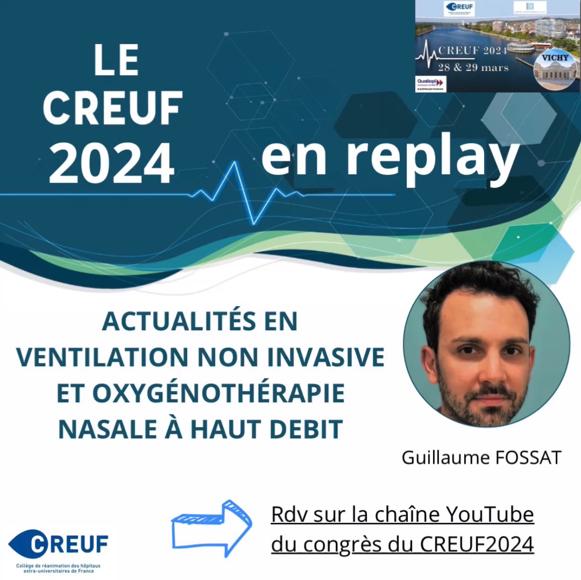 Retour sur le CREUF2024 avec les actualités en ventilation non invasive et oxygénothérapie à haut débit par Guillaume Fossat, Kiné Clinicien Chercheur! Alors installez vous,allez sur la page YouTube du creuf2024,mettez vos écouteurs et profitez! youtu.be/vg7k9xouI6c?si…