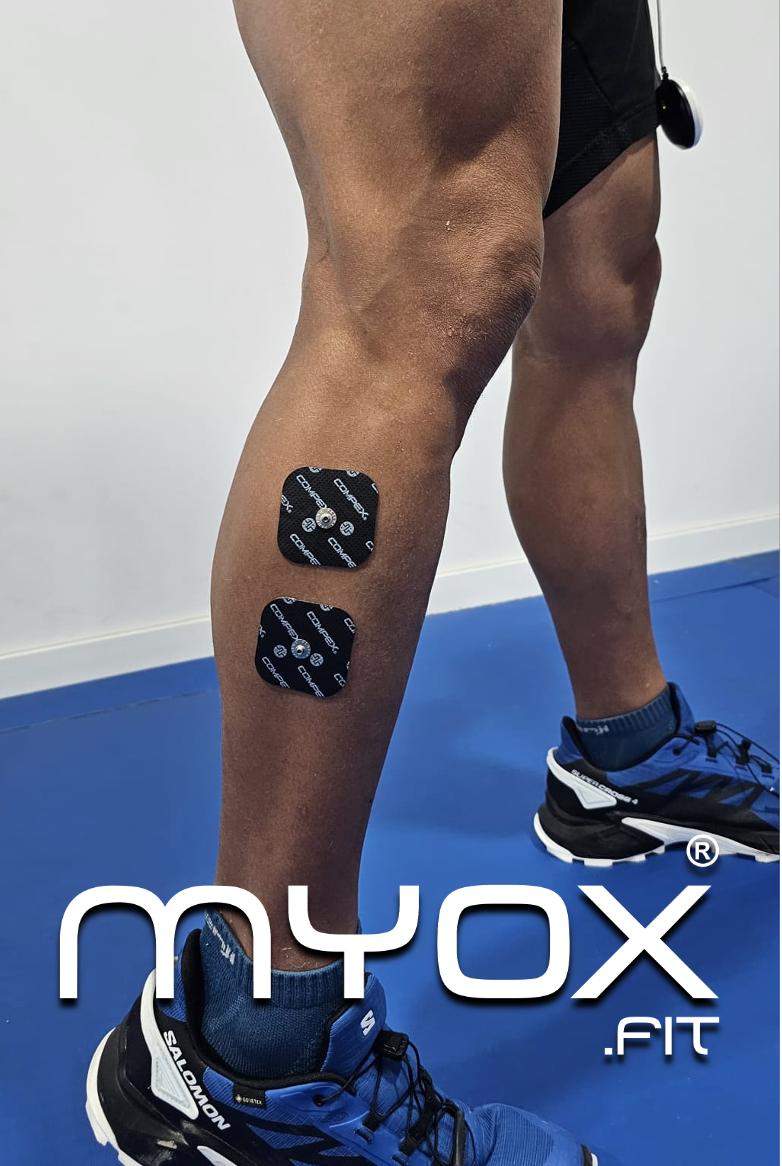 Aplicación de la Electroestimulación Muscular en el músculo Peroneo Lateral Largo para tratamiento y prevención del esguince de tobillo. 

Más información en myox.fit 

#ElectroestimulaciónMuscular #peroneo #Fisioterapia #esguincedetobillo