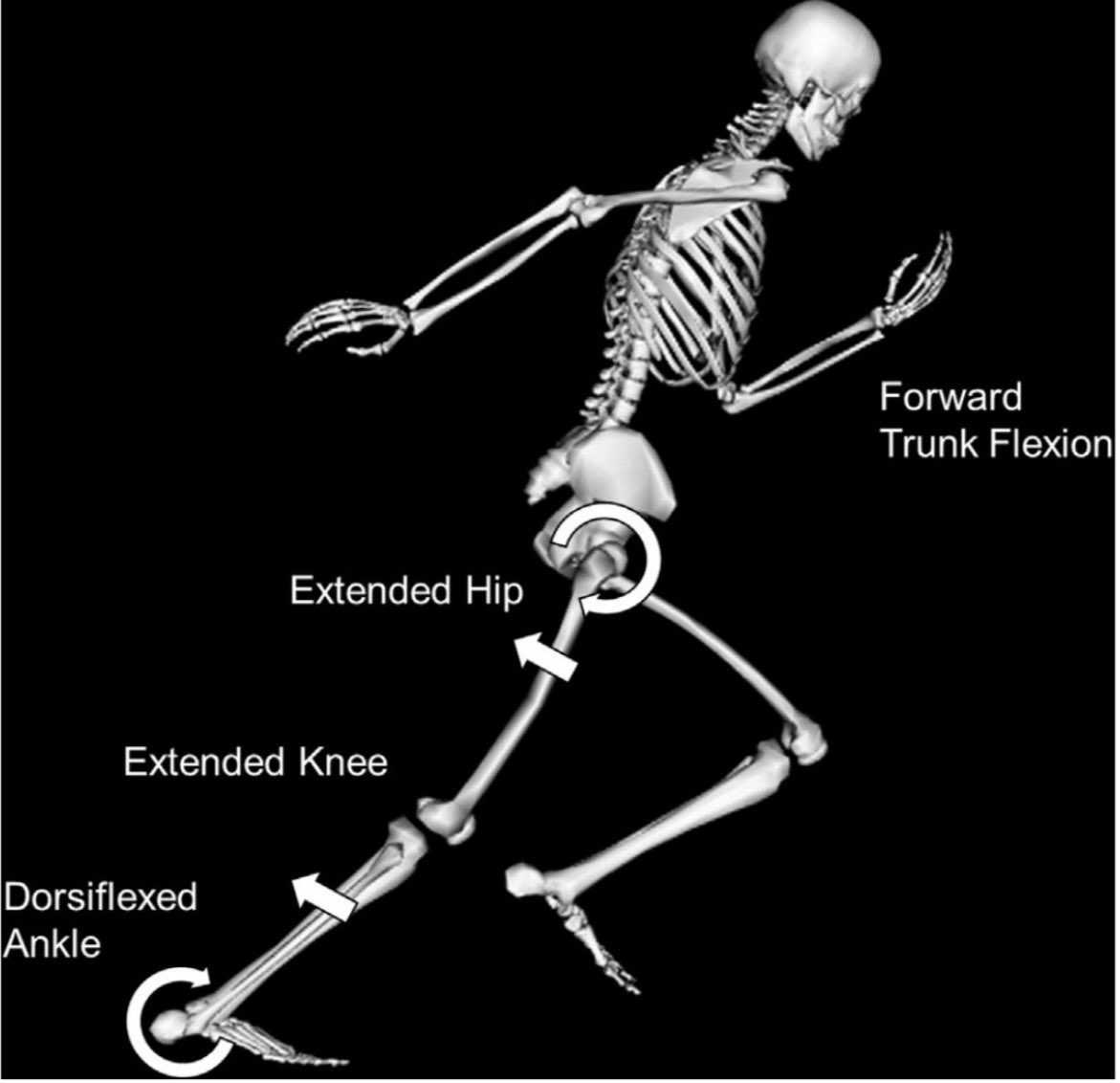 🔴Achilles Tendon Ruptures🔴

Characteristic joint positions at the time of injury consist of: 
 
✅hip extension, 
✅knee extension
✅ankle dorsiflexion
✅ foot abduction
✅foot pronation