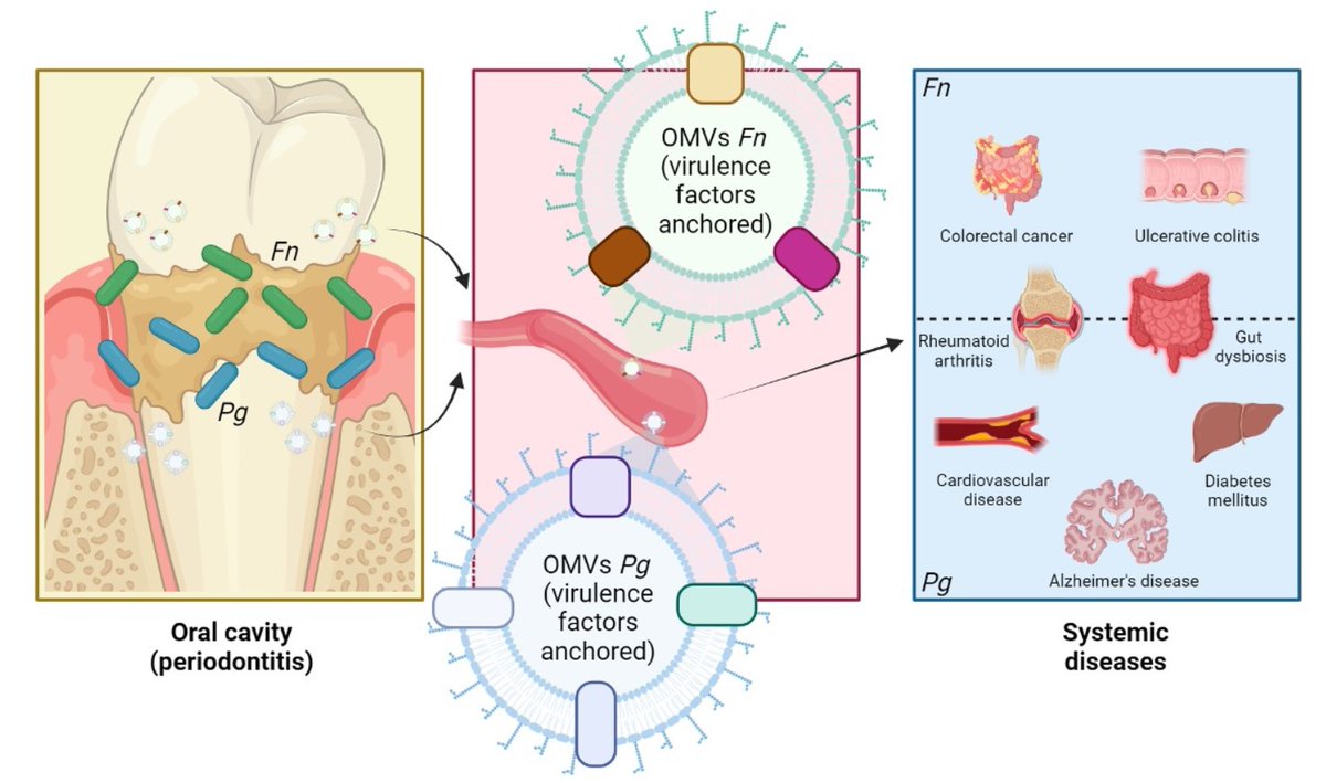 DrJuanFuentes's tweet photo. ¿Bacterias orales que pueden causar enfermedades como trastornos cardiovasculares o deterioro cognitivo? 🤔 Esto lo hacen a través de la producción de pequeñas vesículas que viajan por el torrente sanguíneo. ¡Mira nuestro nuevo artículo!
@Vrid_Unab 
https://t.co/Iv0OLoyfUs https://t.co/9UcuZsyxRl
