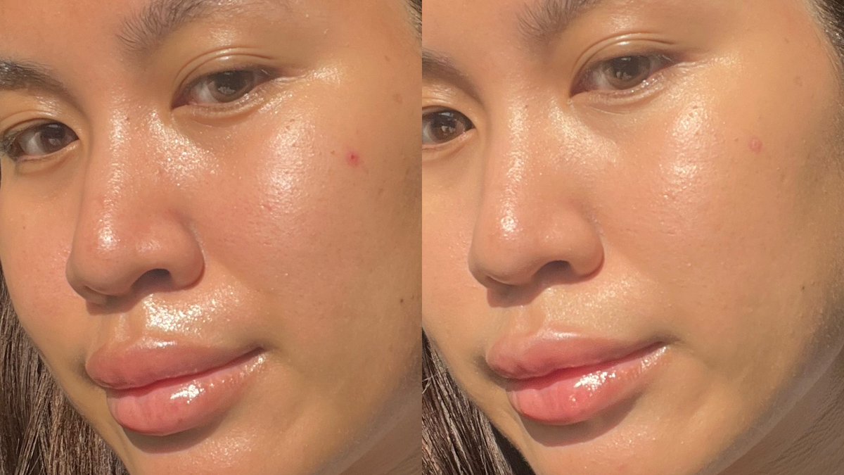 ป้ายยา 2 ไอเท็มของ smooto ที่ลองใช้ละแบบ จึ้ง! ต้องป้ายยาต่อจริง

💙 smooto hya ceramide อันนี้เป็นเซรั่มเนื้อบางๆแต่เข้มข้นดีเลย ตอนนี้ใช้เช้า - เย็นอยู่ตัวเดียวเลย ผิวชุ่มชื้นดีมาก หน้าไม่แห้ง ผิวฉ่ำ สุขภาพดีเลย รู้สึกผิวแข็งแรงดีด้วย ผดผื่นไม่มีทั้งๆที่ผิวเรา sensitive มาก

💛 smooto cushion คุชชั่นแบบซองที่หยิบจากเซเว่นด่วนๆ วันนั้น สู่คุชชั่นที่ชอบมากกกวันนี้ เพราะเนื้อบาง ใช้มือเกลี่ยได้เลย กลืนไปกับผิว ไม่ดรอป เหงื่อเยอะก็ไม่เป็นคราบระหว่างวัน ปกปิดกลางๆ ฟินิชผิวสวยแบบ all day อะ !

#smooto #คุชชั่นซองดำ #มอยส์แอมพูลสมูทโตะ