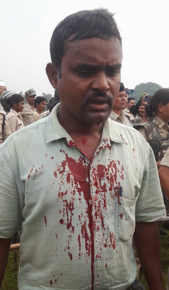 RajuupmanINC's tweet photo. @HansrajMeena संघर्ष आदिवासियों कोई करना होगा प्रकृति को बचाने के लिए @TribalArmy
#SaveHansdev https://t.co/TPG03vY8Up