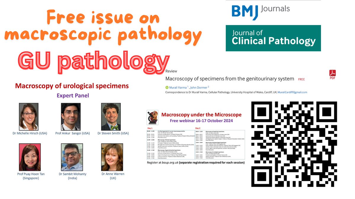 Vikram Deshpande (@vik_deshpandemd) on Twitter photo GU pathology 🚨📷 and papers by some of the very authors speaking. And guess what? The entire March 2024 issue of the Journal of Clinical Pathology is FREE! 📷📷 <a href="/slusagar/">Ankur Sangoi</a> <a href="/MichelleDunno17/">Michelle_Hirsch (Donovan)</a> GU pathology 🚨📷 and papers by some of the very authors speaking. And guess what? The entire March 2024 issue of the Journal of Clinical Pathology is FREE! 📷📷 <a href="/slusagar/">Ankur Sangoi</a> <a href="/MichelleDunno17/">Michelle_Hirsch (Donovan)</a>