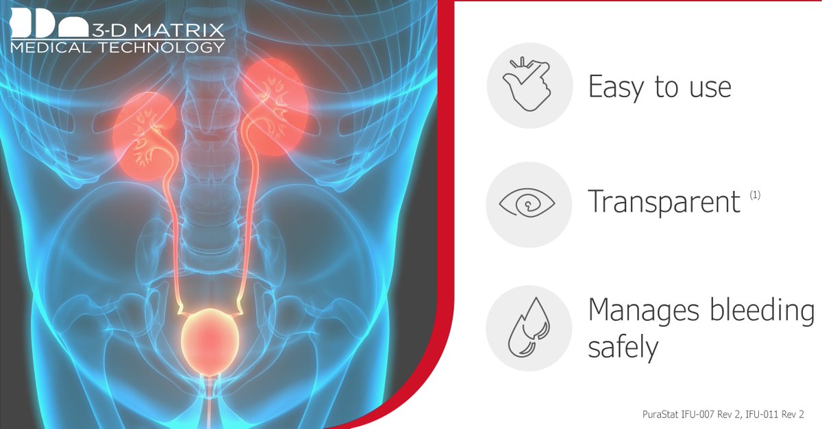 3dm_emea's tweet photo. How can #PuraStat enhance your #UrologyProcedures?
Explore its wide range of applications here: https://t.co/q9JTXXBZrR
#urology #purastat #peptidetechnology #patientoutcomes #bleedingmanagement https://t.co/kOezRmtZ29