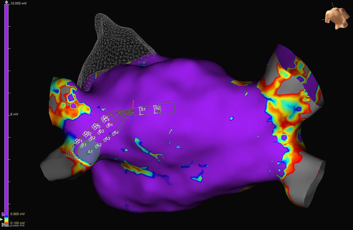 Pasquale V. Falzone tweet media