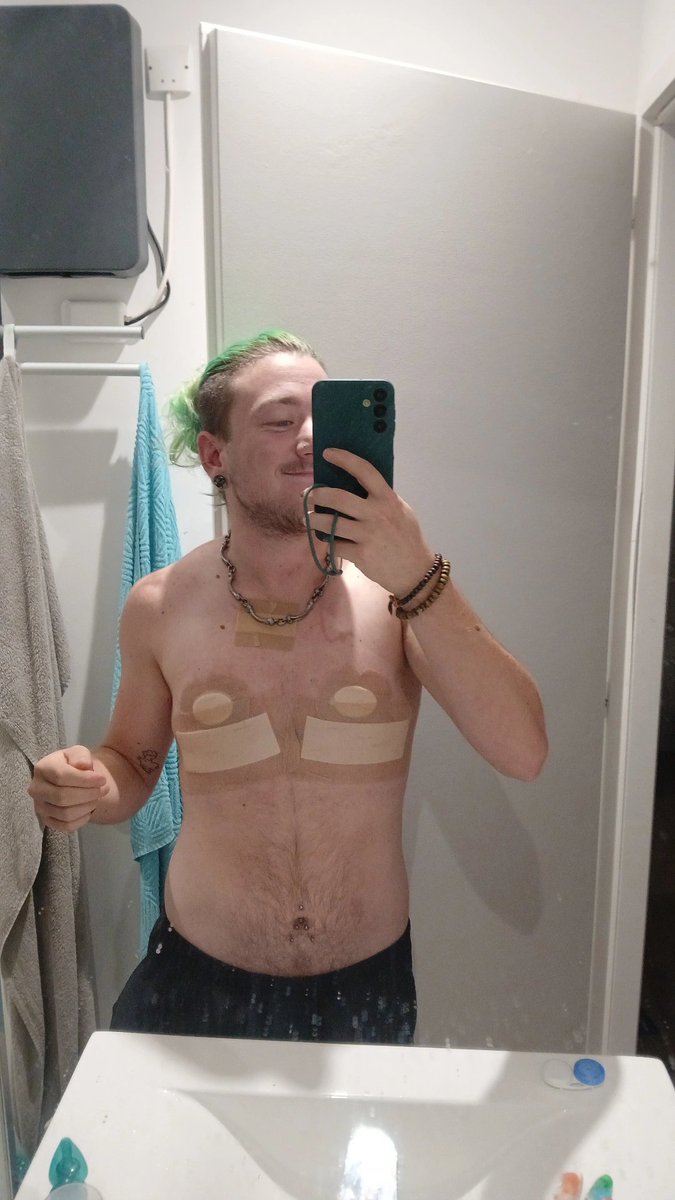 gab_puppy's tweet photo. One week post op #mastectomie https://t.co/PXmfsPqoIR