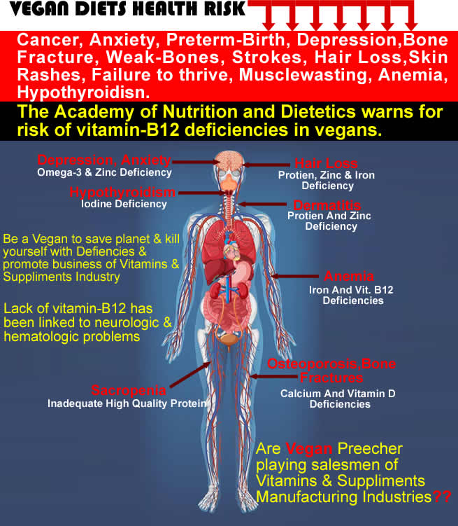 amalnsingh's tweet photo. VEGAN DIETS: Lead to Deficiency of Omega3 Fatty Acid,B-12,Iron,Vit D,Protein,Iodine,Zinc,Magnesium, Calcium. Be Aware of Nutrition 4Health Intricacies with Diploma in Health &amp; Nutrition Accredited by CPD UK    https://t.co/D1a0kYnFkT
@ValerieAnne1970 @dlifein @TheIraSahay #health https://t.co/cbkZQONMJz