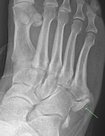 Alabama Orthopedic Imaging tweet media