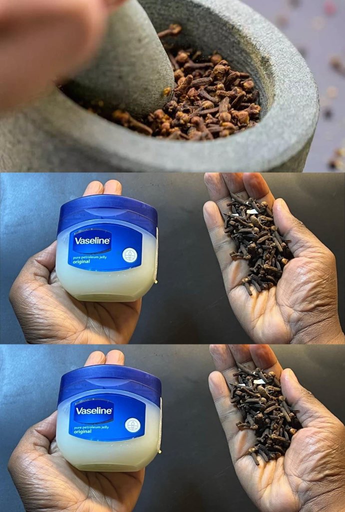 Sana_ShahUk's tweet image. Mix cloves with vaseline: a secret nobody will ever tell you. Thank me later  
👇🏻 complete detail in comments🧵 1/4