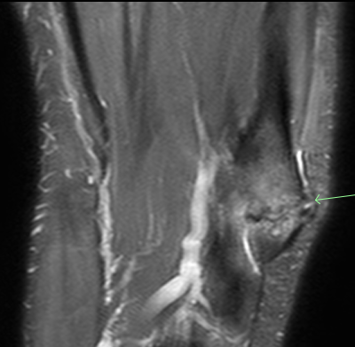 Alabama Orthopedic Imaging tweet media