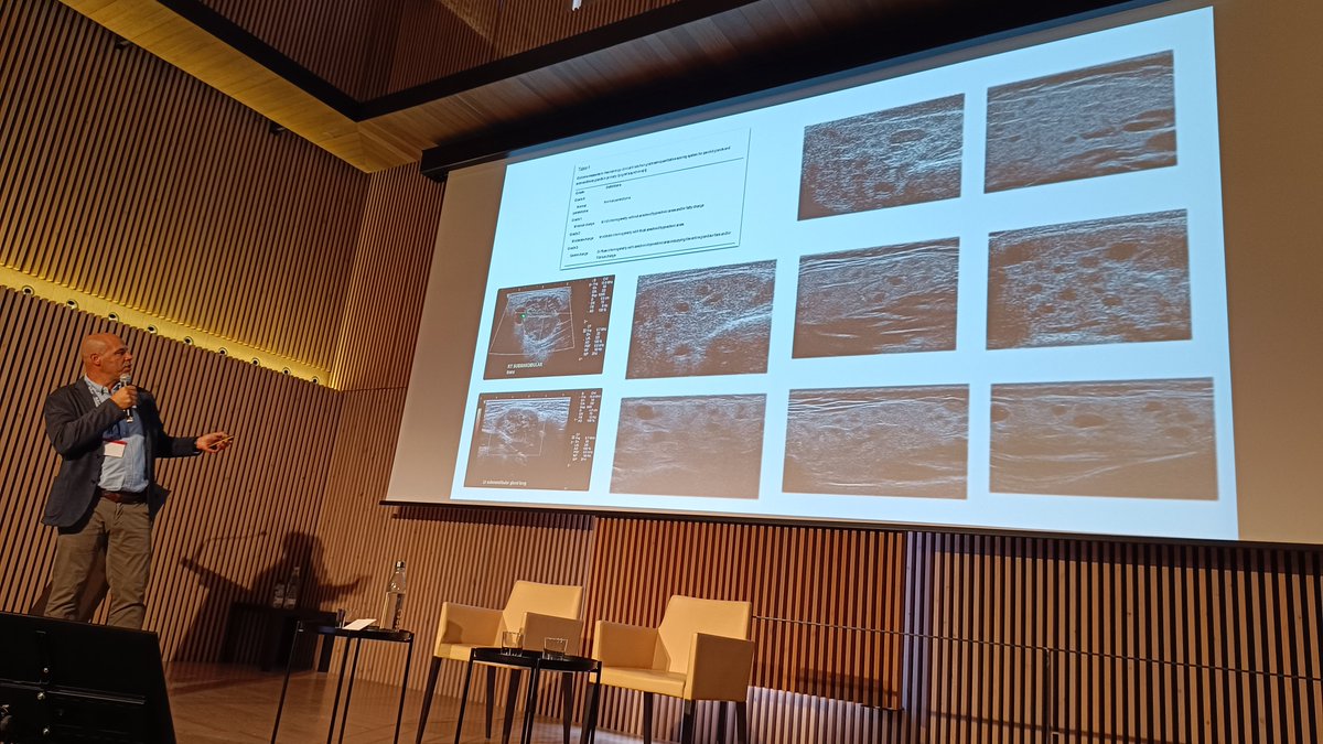 Laurent ARNAUD (@lupusreference) on Twitter photo ✅ Thanks to H. Corominas for showing very interesting data ⬇️ about #ultrasound imaging of salivary glands in #Sjogren disease at the 5th <a href="/SLEuroSociety/">SLEuro</a> Advanced Lupus Workshop. ✅ Thanks to H. Corominas for showing very interesting data ⬇️ about #ultrasound imaging of salivary glands in #Sjogren disease at the 5th <a href="/SLEuroSociety/">SLEuro</a> Advanced Lupus Workshop.