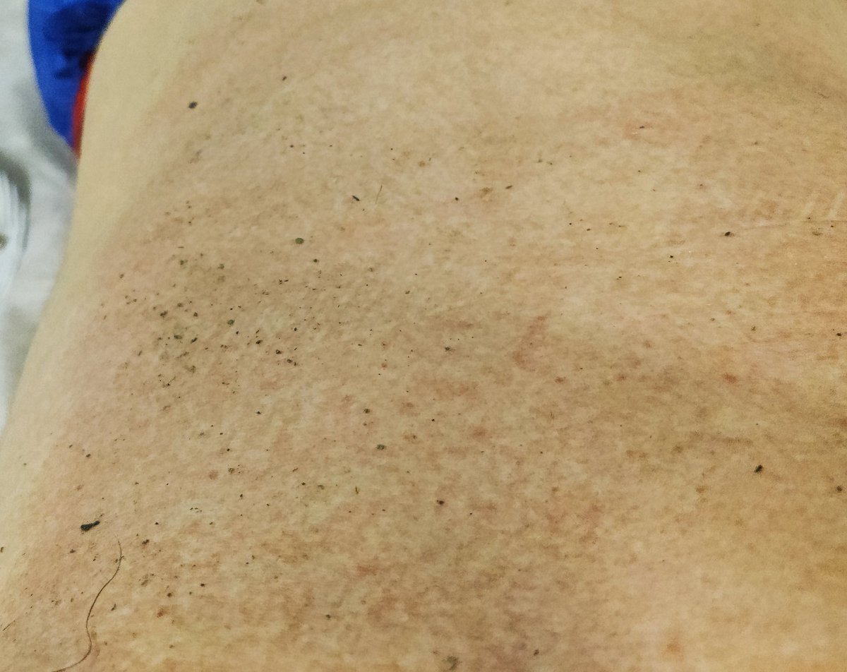 dm_suby's tweet image. 这次除了一些凹凸不平的花纹以及红色的印子，好像还多了很多灰色的东西🤔🤔

#男m #女s #踩踏 #恋足 #踩射 #鞋底 #上海 #调教 #现实 #女王 #踢裆 #乘骑 #舔鞋 #狗奴 #鞋印 #sm #女主