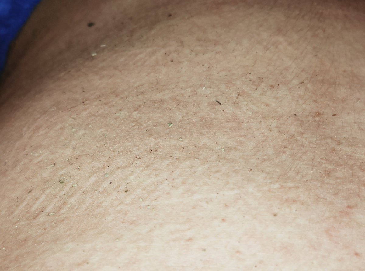 dm_suby's tweet image. 这次除了一些凹凸不平的花纹以及红色的印子，好像还多了很多灰色的东西🤔🤔

#男m #女s #踩踏 #恋足 #踩射 #鞋底 #上海 #调教 #现实 #女王 #踢裆 #乘骑 #舔鞋 #狗奴 #鞋印 #sm #女主