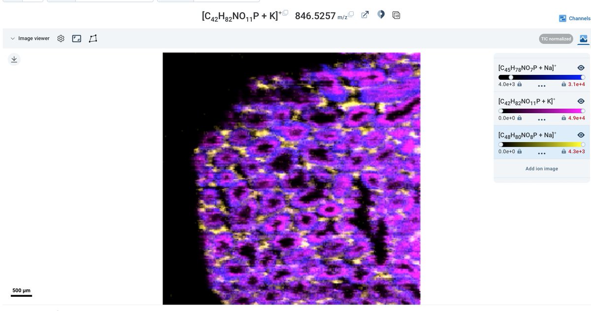 Theodore Alexandrov (@thalexandrov) on Twitter photo So great to see cutting-edge imaging MS data shared on <a href="/metaspace2020/">METASPACE cloud platform for spatial metabolomics</a>: a recent publication from the Janfelt lab on 12 um pixel size DESI with a new sprayer. pubs.acs.org/doi/full/10.10…, public data on METASPACE metaspace2020.eu/project/deffi-…, see e.g. this overlay metaspace2020.eu/annotations?ds… So great to see cutting-edge imaging MS data shared on <a href="/metaspace2020/">METASPACE cloud platform for spatial metabolomics</a>: a recent publication from the Janfelt lab on 12 um pixel size DESI with a new sprayer. pubs.acs.org/doi/full/10.10…, public data on METASPACE metaspace2020.eu/project/deffi-…, see e.g. this overlay metaspace2020.eu/annotations?ds…