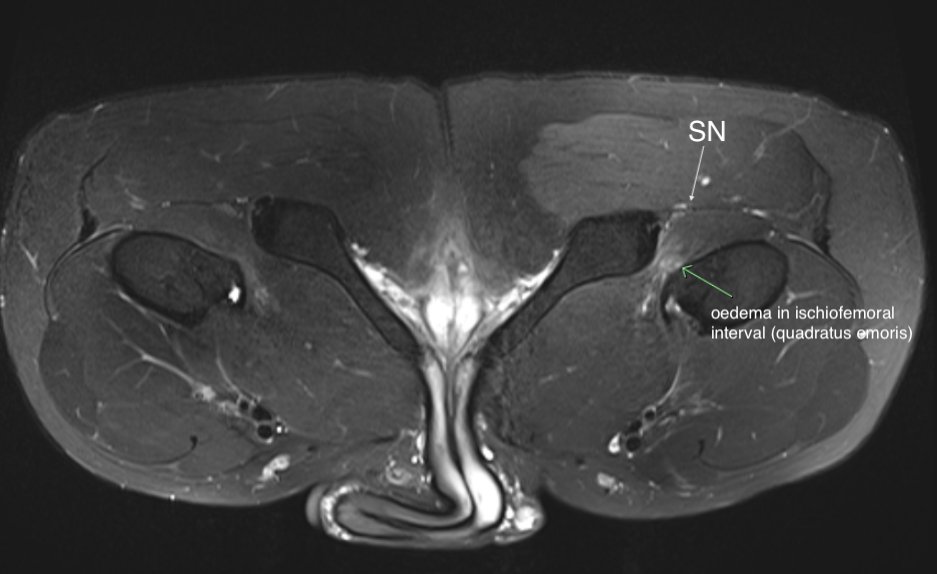 James Noake tweet media