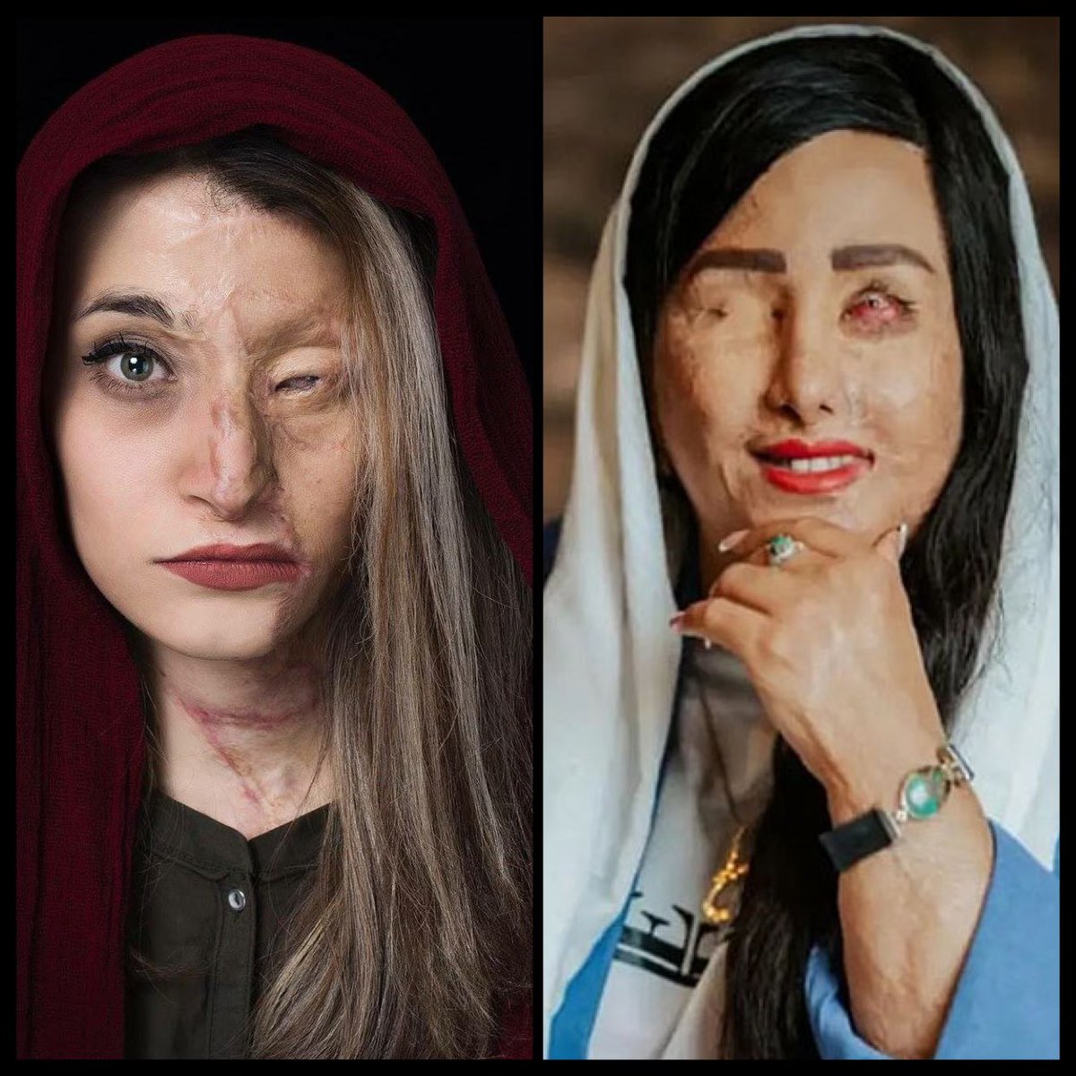 In Iran, the real criminals make the laws. 
Today marks the anniversary of the Isfahan acid attacks on these women, whose “crime” was wearing an improper hijab. Ten years later, the attackers walk free, because why arrest yourself when you hold power? Meanwhile, those who dared