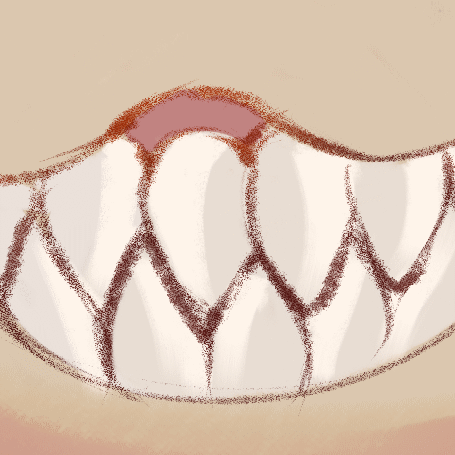 Gorgilisk tweet media