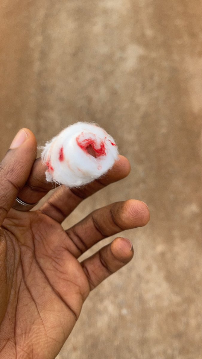 _Innox_'s tweet image. Had a deep cut today, but yet still on the keys &amp;amp; mouse.

#Determination #consistency