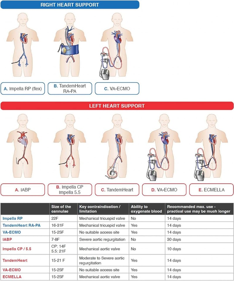 🔴Management of cardiogenic shock, state-of-the-art⤵️  #2024Review #openaccess  

🔹 bit.ly/3XipcV3
 #Cardiology #FOAMed #MedEd #medstudent #paramedic #Cardiology #CardioEd #medtwitter #meded #CardioTwitter #cardiotwiteros  #MedX #cardiovascular #MedTwitter #medical