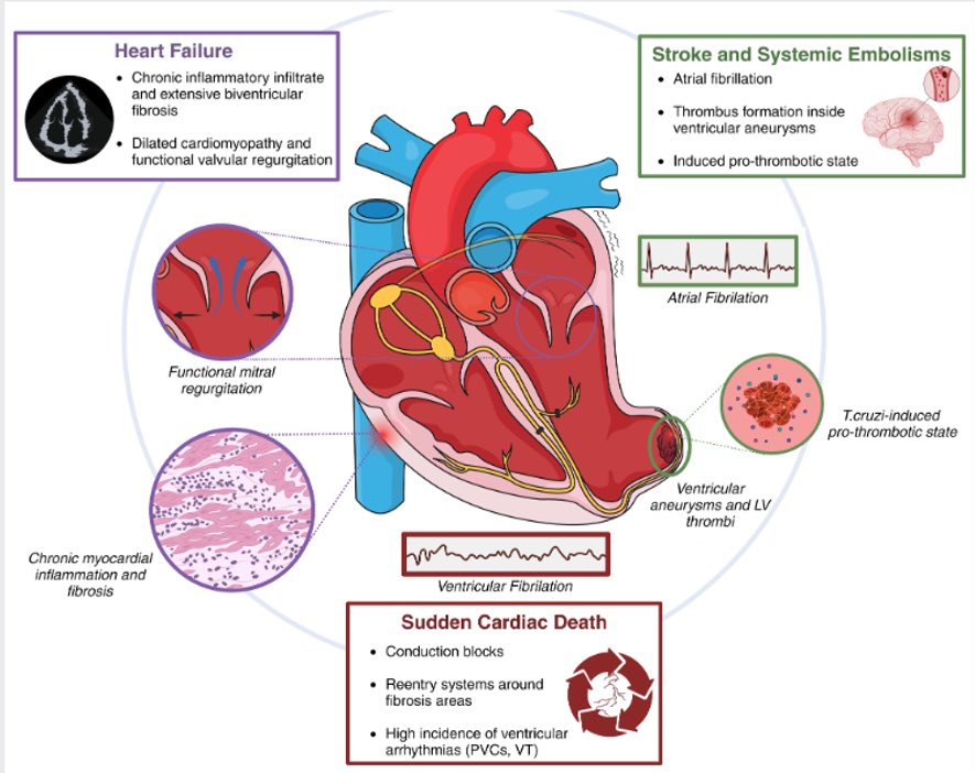 lu_mansur's tweet photo. 💡The rising importance of Chagas disease
👉 nice review on this rare but important topic https://t.co/vX3PARncHK https://t.co/IyN1IyCZqo