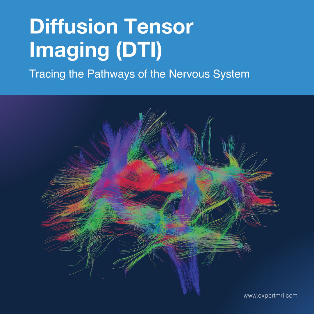 Expert_MRI's tweet photo. 🧠Diffusion Tensor Imaging (DTI): Tracing the Pathways of the Nervous System🧠DTI technology allows us to see the intricate path... https://t.co/VBcoiMnLH9.#DiffusionTensorImaging #DTI #BrainHealth #NeurologicalDisorders #ExpertMRI #AdvancedImaging #BetterDiagnosis #BrainPathways https://t.co/Rs5Bcf2IMb