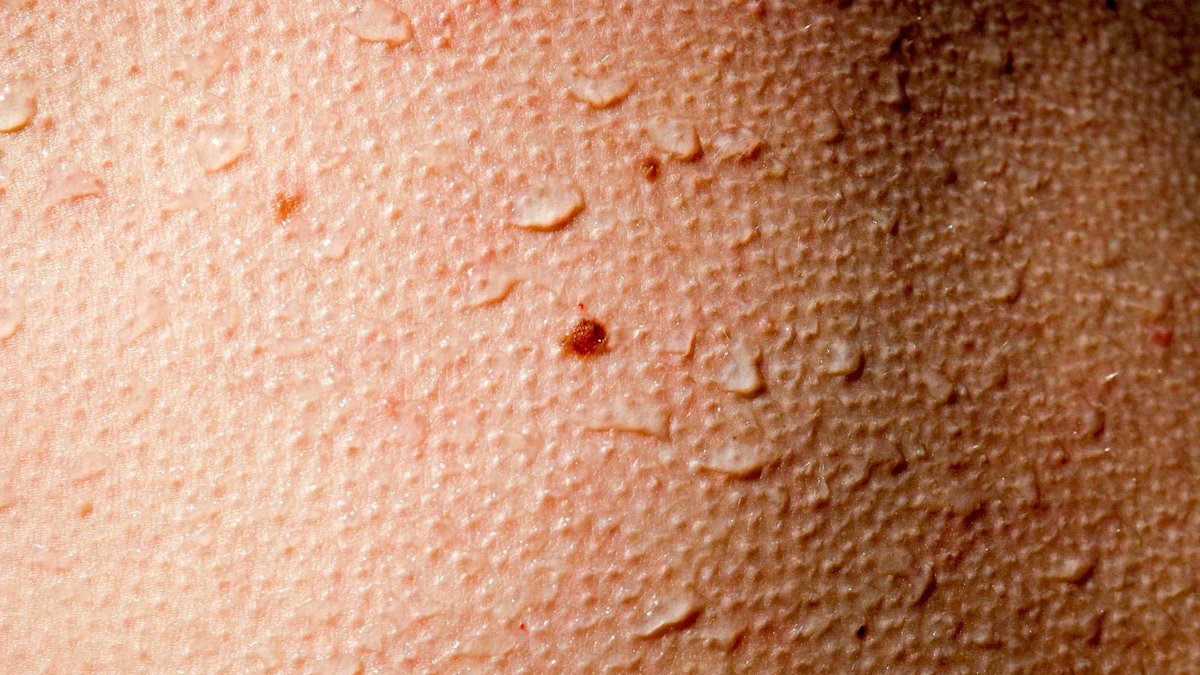 ArtiWig's tweet image. Ever wonder why some actors have big bumps under their wigs? It’s often caused by bulky hair, poor wig fit, or improper styling! 
#WigTips 
#BehindTheScenes 
#HollywoodSecrets
Detail: artiwig.com/blogs/wig-tips…