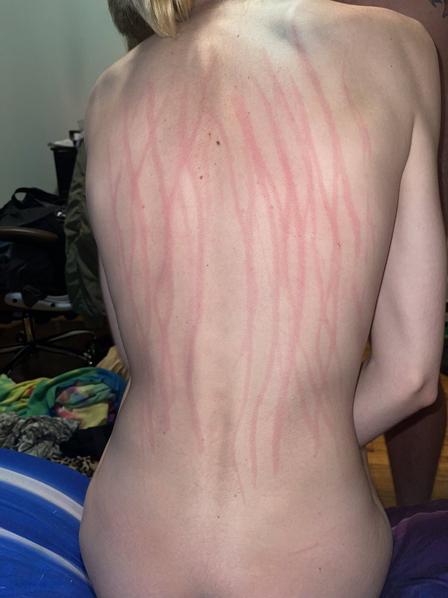 FarrahBites's tweet photo. Scratcher? I hardly know her

#onlyfans #contentcreator #trans https://t.co/I8GItZzrl7