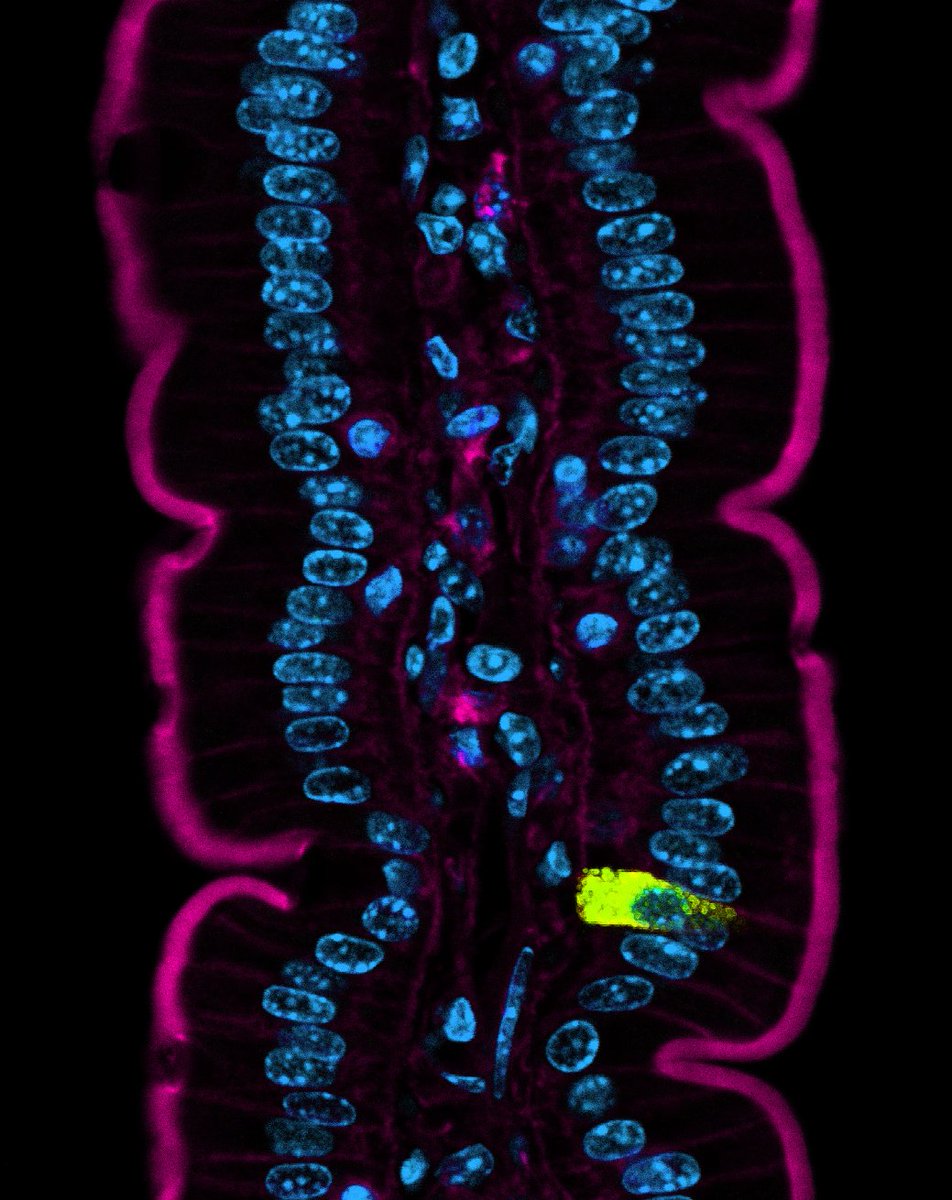 AmyEngevik's tweet photo. #MicroscopyMonday featuring an enteroendocrine cell https://t.co/3fGnDJbwfu