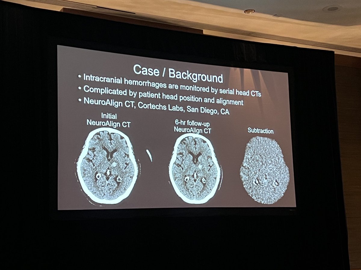 Niky Farid (@drnikyfarid) on Twitter photo So proud of our medical student Lee Hsieh for his clear and eloquent presentation @ #WNRS24 on improved detection of change in intracranial hemorrhage with NeuroAlign CT <a href="/wnrsociety/">The Western Neuroradiological Society</a> <a href="/UCSDImaging/">UCSD Imaging</a> <a href="/Cortechs_ai/">Cortechs.ai</a> <a href="/UCSDMedSchool/">UC San Diego School of Medicine</a> So proud of our medical student Lee Hsieh for his clear and eloquent presentation @ #WNRS24 on improved detection of change in intracranial hemorrhage with NeuroAlign CT <a href="/wnrsociety/">The Western Neuroradiological Society</a> <a href="/UCSDImaging/">UCSD Imaging</a> <a href="/Cortechs_ai/">Cortechs.ai</a> <a href="/UCSDMedSchool/">UC San Diego School of Medicine</a>