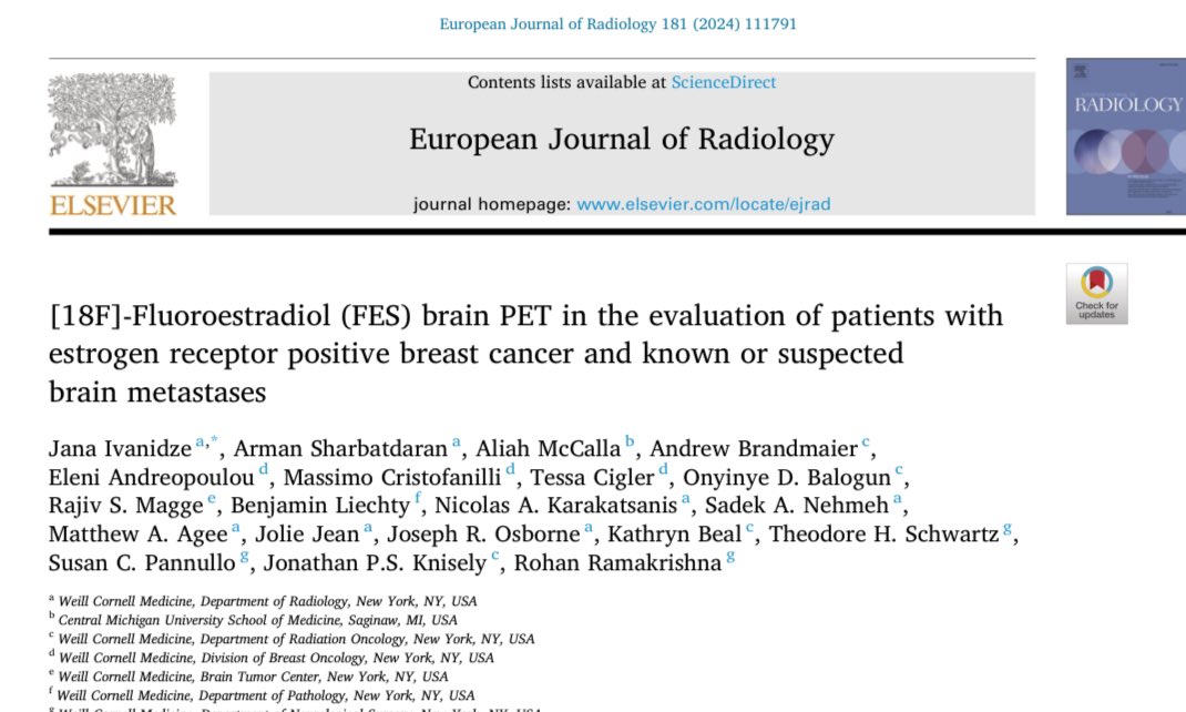 Jana Ivanidze (@jana_ivanidze) on Twitter photo Another amazing <a href="/WeillCornell/">Weill Cornell Medicine</a> collaboration ๐ #teamscience <a href="/WCMRadiology/">Weill Cornell Medicine Radiology</a> <a href="/MolecularWCM/">WCM Molecular Imaging and Therapeutics</a> <a href="/WCMBreastCenter/">Weill Cornell Breast Center</a> <a href="/WCMCPathology/">Weill Cornell Medicine Pathology</a> @WCMNeurosurgery
<a href="/sharbatdara1/">Arman Sharbatdaran</a>
<a href="/drRohanR/">Rohan Ramakrishna MD</a> <a href="/TedSchwartz13/">Theodore Schwartz MD</a> @MCristofanill <a href="/JolieJeanMD/">Jolie Jean, MD</a> <a href="/nkarakatsanis/">Nicolas Karakatsanis</a> @JOsbMD & others ๐
2/2 Another amazing <a href="/WeillCornell/">Weill Cornell Medicine</a> collaboration ๐ #teamscience <a href="/WCMRadiology/">Weill Cornell Medicine Radiology</a> <a href="/MolecularWCM/">WCM Molecular Imaging and Therapeutics</a> <a href="/WCMBreastCenter/">Weill Cornell Breast Center</a> <a href="/WCMCPathology/">Weill Cornell Medicine Pathology</a> @WCMNeurosurgery
<a href="/sharbatdara1/">Arman Sharbatdaran</a>
<a href="/drRohanR/">Rohan Ramakrishna MD</a> <a href="/TedSchwartz13/">Theodore Schwartz MD</a> @MCristofanill <a href="/JolieJeanMD/">Jolie Jean, MD</a> <a href="/nkarakatsanis/">Nicolas Karakatsanis</a> @JOsbMD & others ๐
2/2