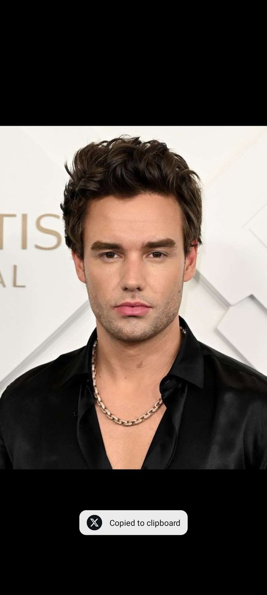 theOjesh's tweet photo. One Direction singer Liam Payne 'Jumped from the Balcony of His Room' Before His Death at 31, Authorities Say

RIP Liam 🕊️💔🙏
#Liam_Payne https://t.co/9gIfzI8Yyy