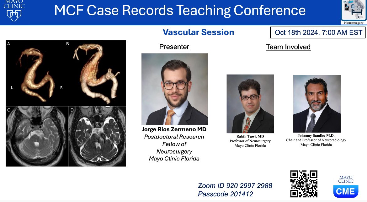 Adrian Safa M.D. (@adrian_safa) on Twitter photo Donāt forget to join us tomorrow for another exciting vascular session with Dr. <a href="/JorgeRios_MD/">Jorge Rios Zermeno MD</a> presenting a very interesting case by <a href="/RabihTawkMD/">Rabih Tawk</a> <a href="/jsandhu11/">Johnny Sandhu</a>
<a href="/DoctorQMd/">Dr. Alfredo QuiƱones-Hinojosa</a> <a href="/janhachmann/">Jan Hachmann MD MS MBA</a> <a href="/MayoClinicNeuro/">Mayo Clinic Neuro</a> <a href="/ManuelaAB99/">Manuela Aramburu Berckemeyer, MD</a> <a href="/jpnavarro_md/">Juan P. Navarro-Garcia de Llano</a> <a href="/JEmilianoSG/">J. Emiliano Sanchez-Garavito M.D.</a> <a href="/lmichmd/">Loizos Michaelides, MD</a> <a href="/ekert_justyna/">Justyna Ekert</a> Donāt forget to join us tomorrow for another exciting vascular session with Dr. <a href="/JorgeRios_MD/">Jorge Rios Zermeno MD</a> presenting a very interesting case by <a href="/RabihTawkMD/">Rabih Tawk</a> <a href="/jsandhu11/">Johnny Sandhu</a>
<a href="/DoctorQMd/">Dr. Alfredo QuiƱones-Hinojosa</a> <a href="/janhachmann/">Jan Hachmann MD MS MBA</a> <a href="/MayoClinicNeuro/">Mayo Clinic Neuro</a> <a href="/ManuelaAB99/">Manuela Aramburu Berckemeyer, MD</a> <a href="/jpnavarro_md/">Juan P. Navarro-Garcia de Llano</a> <a href="/JEmilianoSG/">J. Emiliano Sanchez-Garavito M.D.</a> <a href="/lmichmd/">Loizos Michaelides, MD</a> <a href="/ekert_justyna/">Justyna Ekert</a>