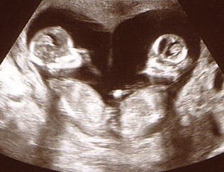 She looks at @NirvanaDeos and grins.

“Hey, Tarzan… I love you. Hope you’re ready for this house to be filled with girls…”