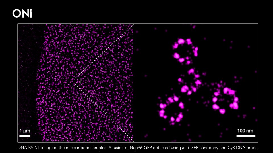 oniHQ's tweet photo. 🔬 It's #FluorescenceFriday and today we have detailed #DNAPAINT image of #NuclearPoreComplexes. 👩‍🔬

🚀 We recently teamed up with Massive Photonics to offer DNA PAINT reagents that are optimized for the #Nanoimager and we are excited to see what our users can do with it them!🔬 https://t.co/wRBI3LqFoX