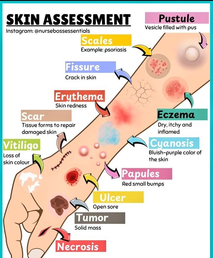 Gazal6849's tweet image. 🔴Skin assessment by Nurse Boss essentials