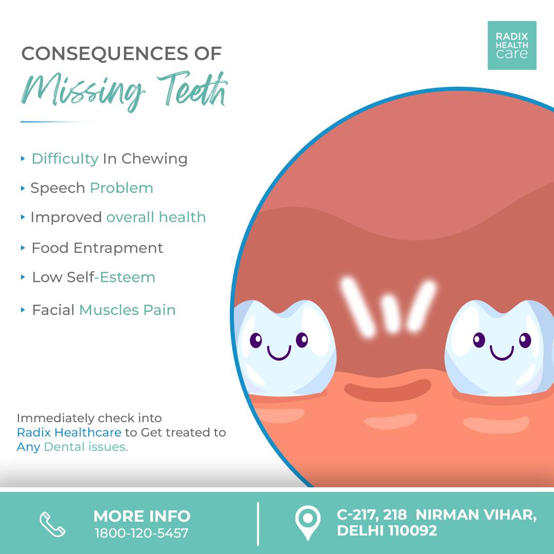 radixhealthcare's tweet photo. Are you suffering from missing teeth?

Here are some consequences.

For more details call 1800-120-5457 or visit https://t.co/O2Uydk2B18

#radixhealthcare #missingteeth #dental #dentalcare #teeth #tooth #oral #oralcare #teethgaps #dentalimplants #dentist #treatment #hospital https://t.co/2FwigRMLbY
