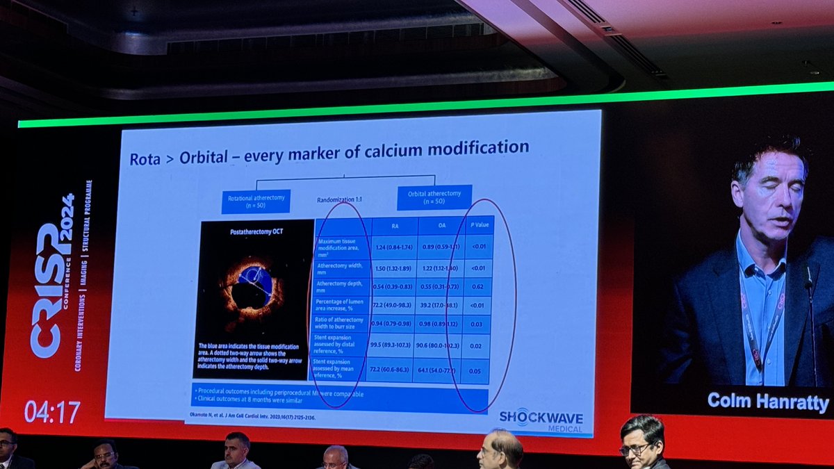 "Better to stall a burr in the artery than be in the pericardium "😄 says <a href="/cghanratty/">@colmhanratty</a>