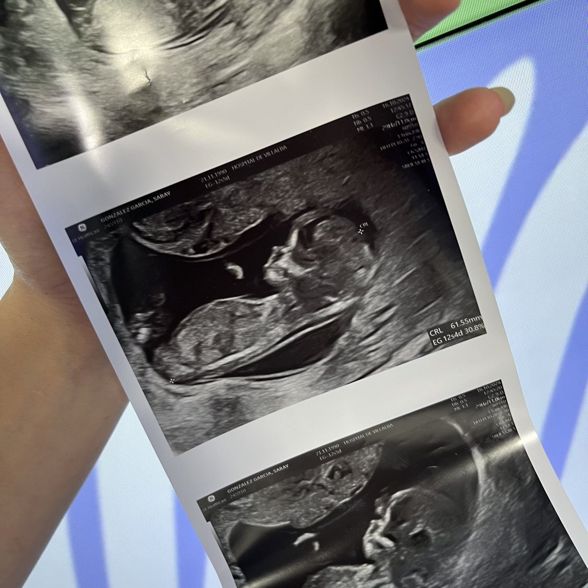 🍼💚 ¡LA FAMILIA ATREVIDA CRECE! Nuestra <a href="/SarayEsteso/">Saray Esteso</a> está EMBARAZADA 🥹

🥰 Saray nos lo ocultó a todos… ¡Y lo anunció por sorpresa en pleno directo! 🥳 Estamos suuuper emocionados y deseando que llegue el 25 de abril 🫶🏼

<a href="/Cadena_Dial/">Cadena Dial España</a>