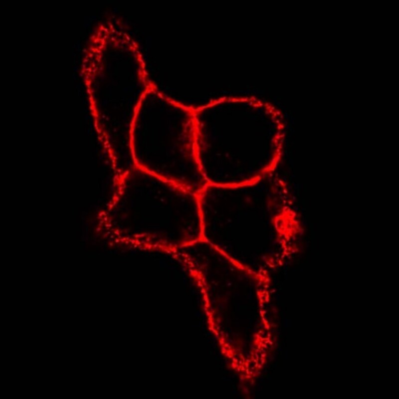 CSIC's tweet image. 🔬Investigadores de @ciccancer descubren un mecanismo de resistencia a medicación en uno de los tipos de cáncer de mama más agresivo.

🩺El hallazgo contribuye a la personalización en las terapias para pacientes con tumores HER2 positivo.

➡️ tinyurl.com/3227xsxj