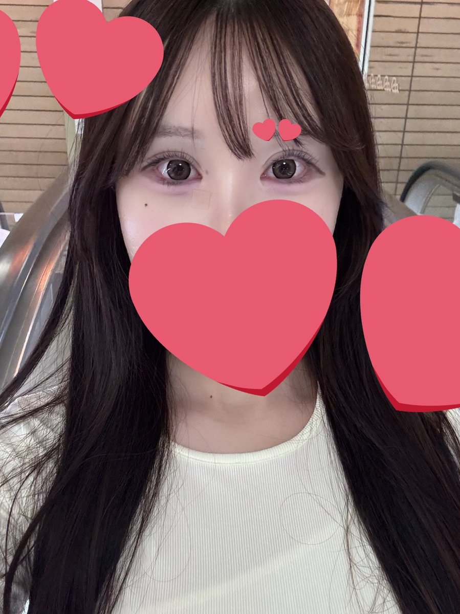 pp_4648's tweet photo. プロミス整形外科で受けた自然癒着本当に可愛すぎてお気に入り♡ https://t.co/OK4s8T0up4
