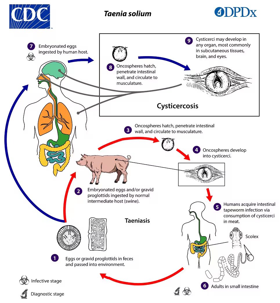 Nate_path's tweet photo. Cystic brain lesion. Maybe I’ll stay away from those ham sandwiches for a while 🙈 #PathX #Crittersontwitter https://t.co/te9zW5fiey