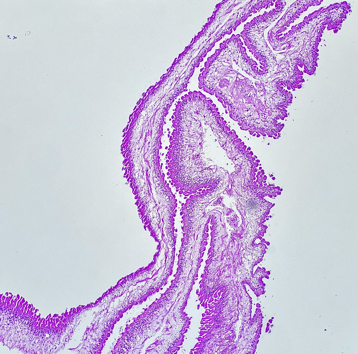 Nate_path's tweet photo. Cystic brain lesion. Maybe I’ll stay away from those ham sandwiches for a while 🙈 #PathX #Crittersontwitter https://t.co/te9zW5fiey