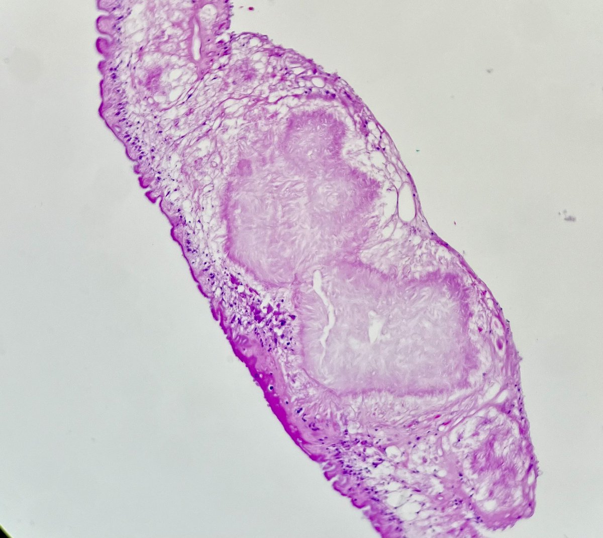 Nate_path's tweet photo. Cystic brain lesion. Maybe I’ll stay away from those ham sandwiches for a while 🙈 #PathX #Crittersontwitter https://t.co/te9zW5fiey
