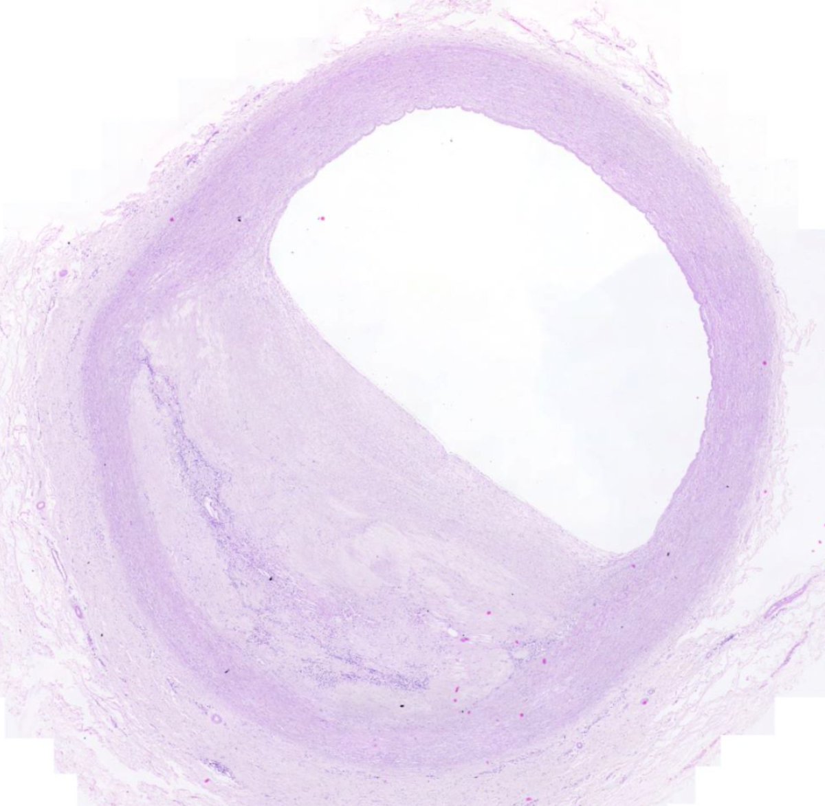 microscopio_v's tweet image. Viernes con nuevos preparados!
✨🔬🆕✨
Están online los preparados problema para el módulo de Ap. Cardiovascular ❤️🤔
microscopiovirtual.fmed.edu.uy/c_ap_cardiovas…
(es el "problema 3" para el curso de HNCR 2024)