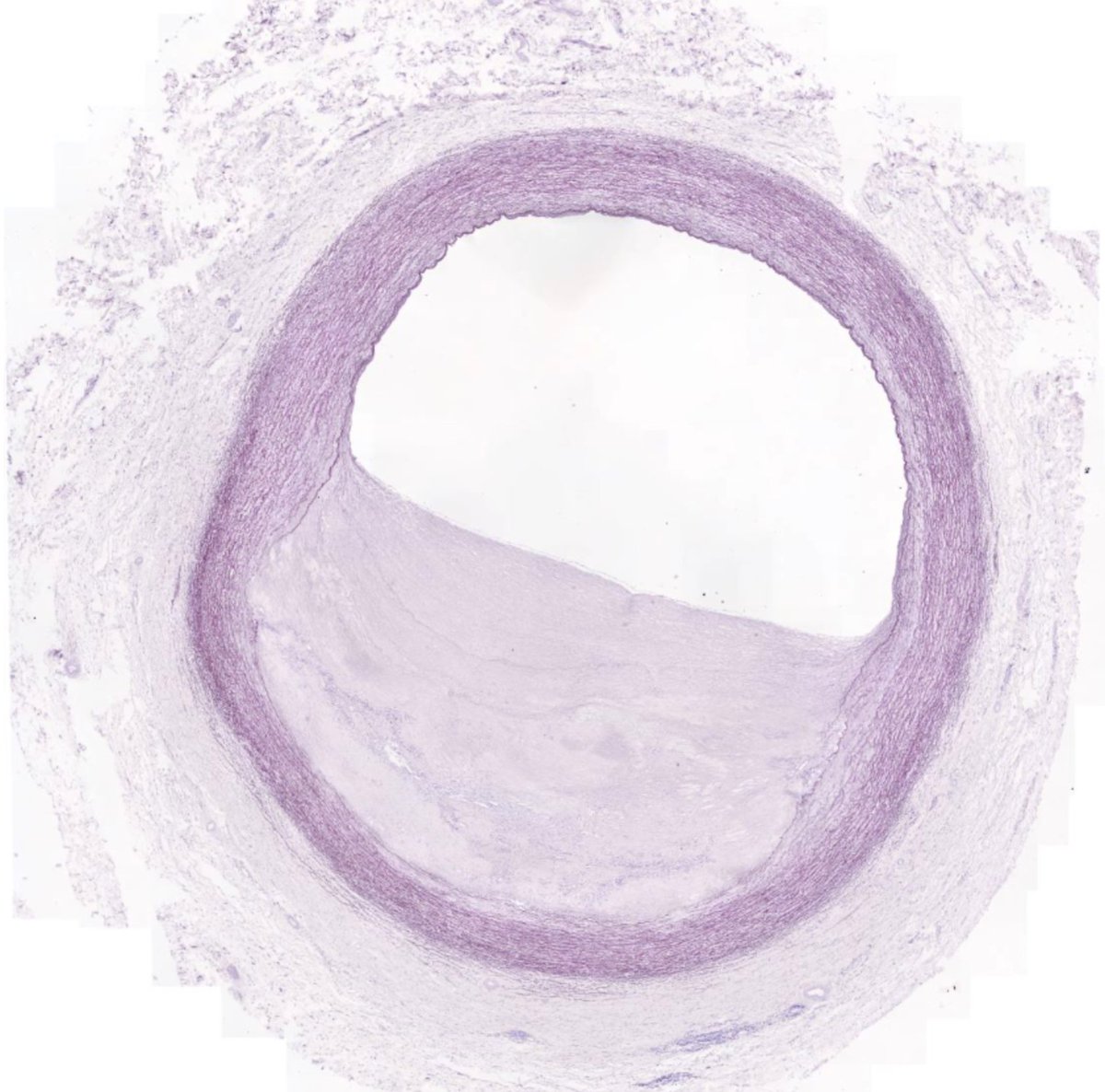 microscopio_v's tweet image. Viernes con nuevos preparados!
✨🔬🆕✨
Están online los preparados problema para el módulo de Ap. Cardiovascular ❤️🤔
microscopiovirtual.fmed.edu.uy/c_ap_cardiovas…
(es el "problema 3" para el curso de HNCR 2024)