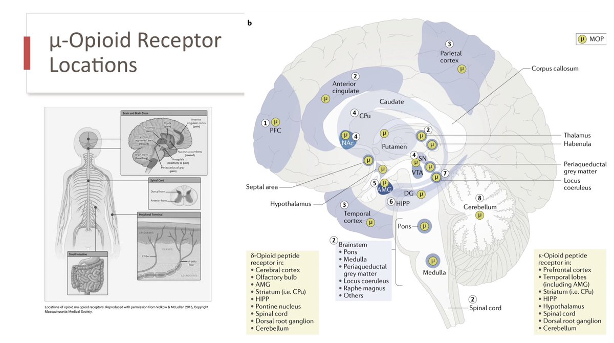 Sean Barnes (he/him), MD, MBA (@drseanbarnes) on Twitter photo <a href="/AmberBoruckiMD/">Amber Borucki, MD</a> - highlighting the #opioid cellular response
#PedsAnes24 #PedsAnes #PedsICU #PedsPain <a href="/stanfordanes/">Stanford Anesthesiology</a> <a href="/AmberBoruckiMD/">Amber Borucki, MD</a> - highlighting the #opioid cellular response
#PedsAnes24 #PedsAnes #PedsICU #PedsPain <a href="/stanfordanes/">Stanford Anesthesiology</a>