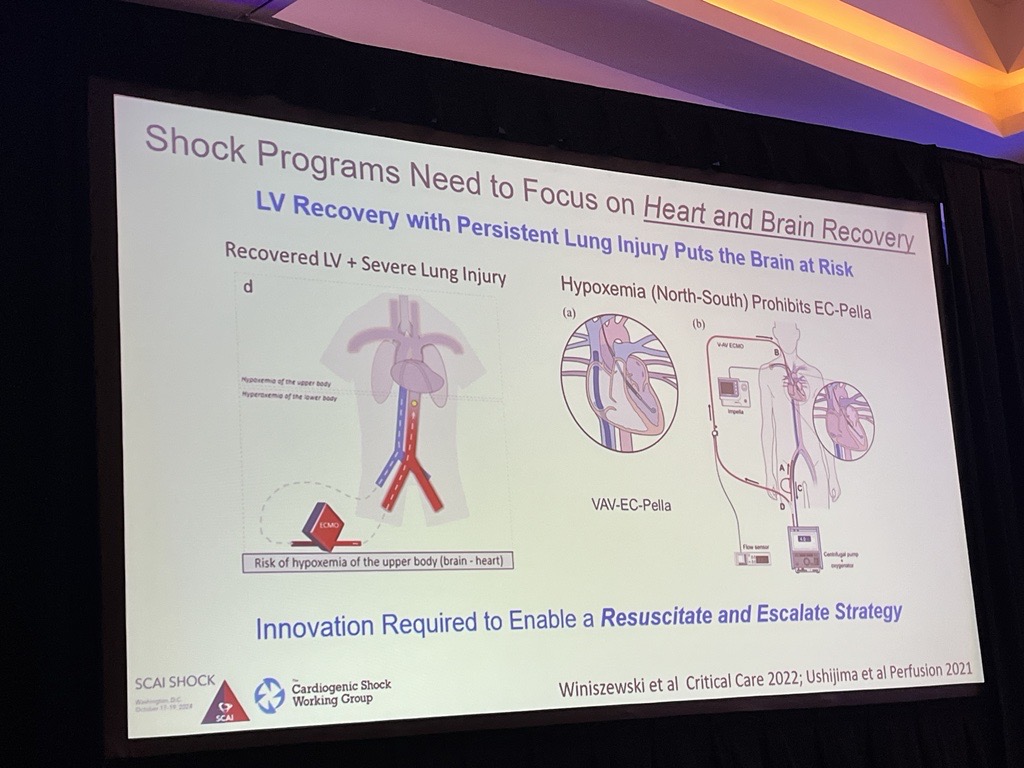 The role of extracorporeal life support (ECLS) is important for the management of shock states. <a href="/NavinKapur4/">Navin Kapur</a> discusses #ECMO therapy for #CardiogenicShock at #SCAISHOCK.

<a href="/NavinKapur4/">Navin Kapur</a> <a href="/DrChuckSimonton/">Chuck Simonton</a> <a href="/JasonKatzMD/">Jason N. Katz</a> <a href="/SandeepNathanMD/">Sandeep Nathan, MD, MSc</a> <a href="/BillONeillMD/">William W. O'Neill</a>