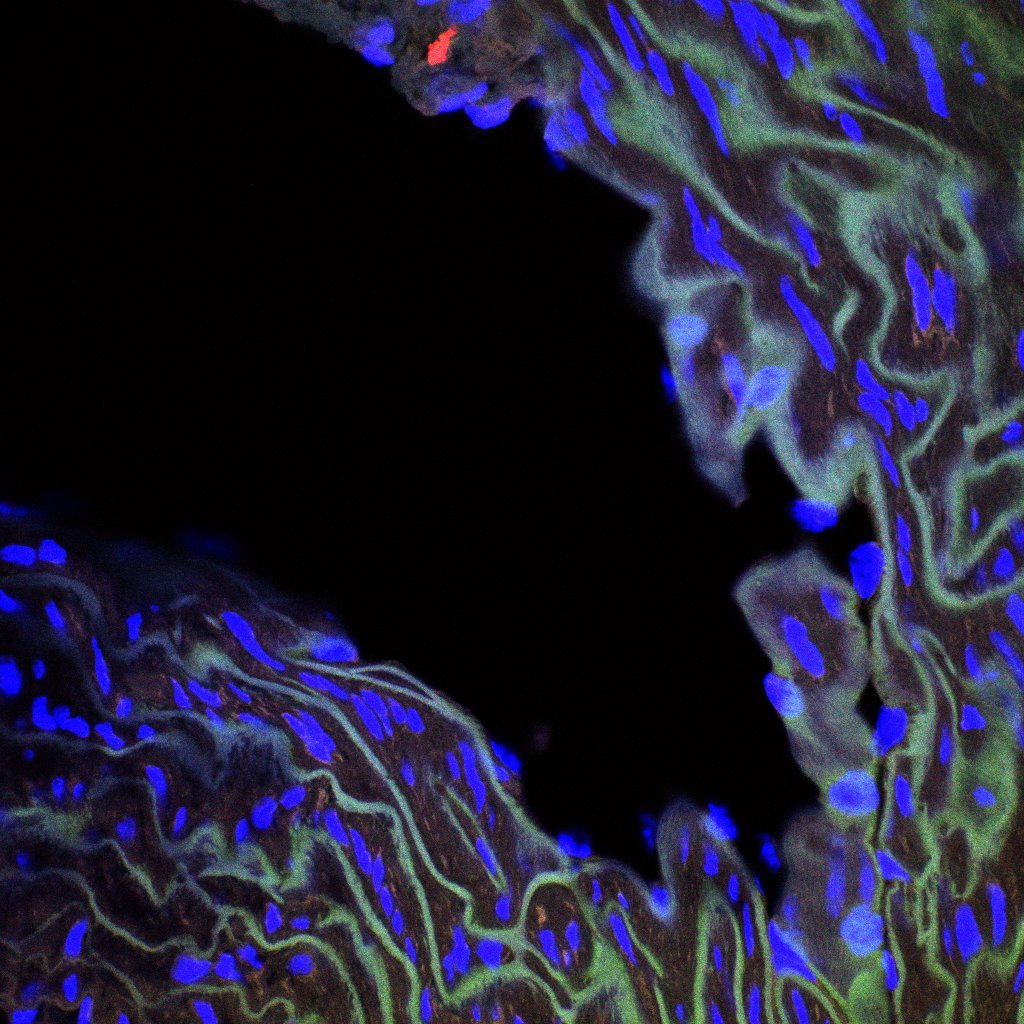 .<a href="/KanCaoumd/">Kan Cao</a>'s lab made a discovery that could yield better treatments for progeria, a rare premature aging disorder sometimes called the "Benjamin Button disease."

Read more about their paper, out now in <a href="/Aging_Cell/">Aging_Cell</a>: go.umd.edu/1sxb