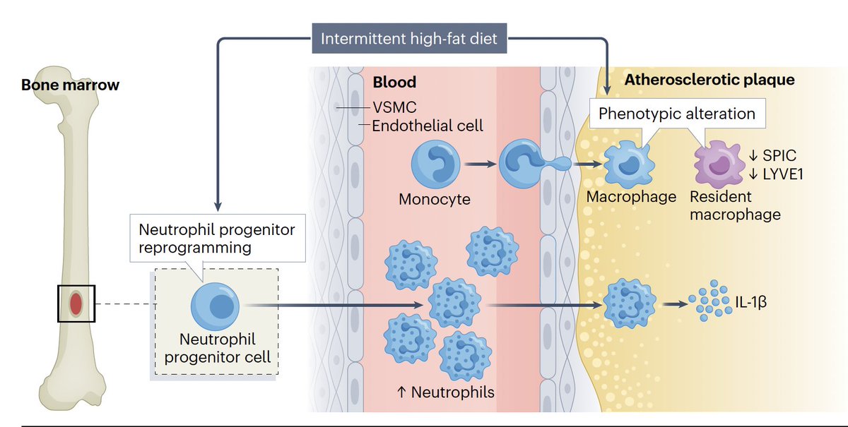 Eric Topol (@erictopol) on Twitter photo Why intermittent consumption of a high-fat diet may be bad for you; it reprograms macrophages and white blood cells and accelerates atherosclerosis. Succinct summary of 2 recent studies <a href="/justsaysinmice/">justsaysinmice</a> nature.com/articles/s4156…
<a href="/cj_binder/">Christoph Binder</a> <a href="/NatRevCardiol/">Nature Reviews Cardiology</a> Why intermittent consumption of a high-fat diet may be bad for you; it reprograms macrophages and white blood cells and accelerates atherosclerosis. Succinct summary of 2 recent studies <a href="/justsaysinmice/">justsaysinmice</a> nature.com/articles/s4156…
<a href="/cj_binder/">Christoph Binder</a> <a href="/NatRevCardiol/">Nature Reviews Cardiology</a>